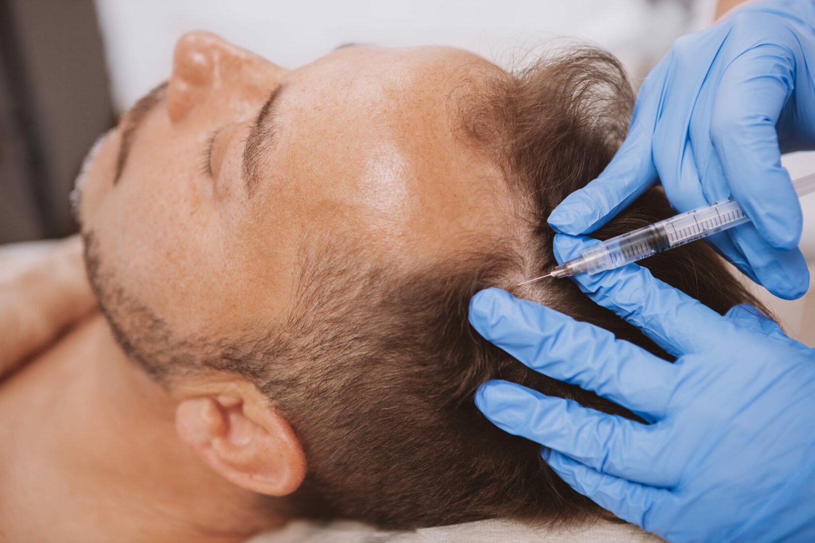 RP Injections for Hair Loss in Edgewater, New Jersey