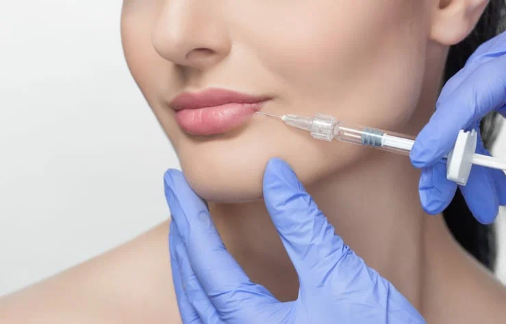 Lip Fillers in Edgewater, New Jersey