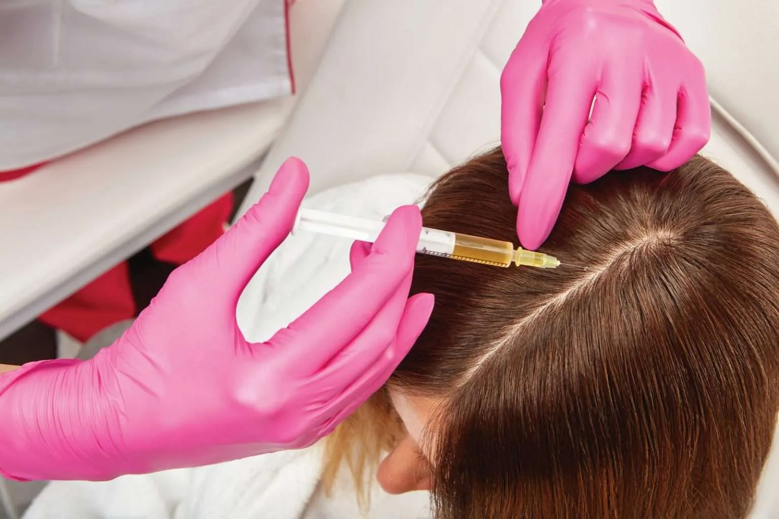 RP Injections for Hair Loss in Edgewater, New Jersey