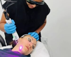 laser hair removal