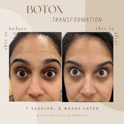Before-After -4