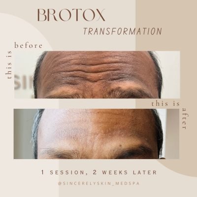 Before-After -5