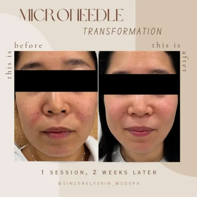 Before-After -8
