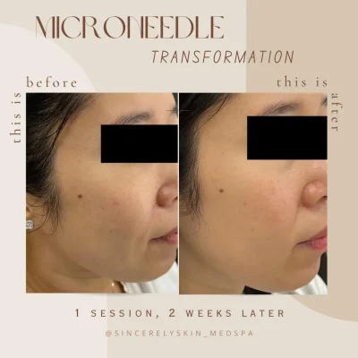 Before-After -9